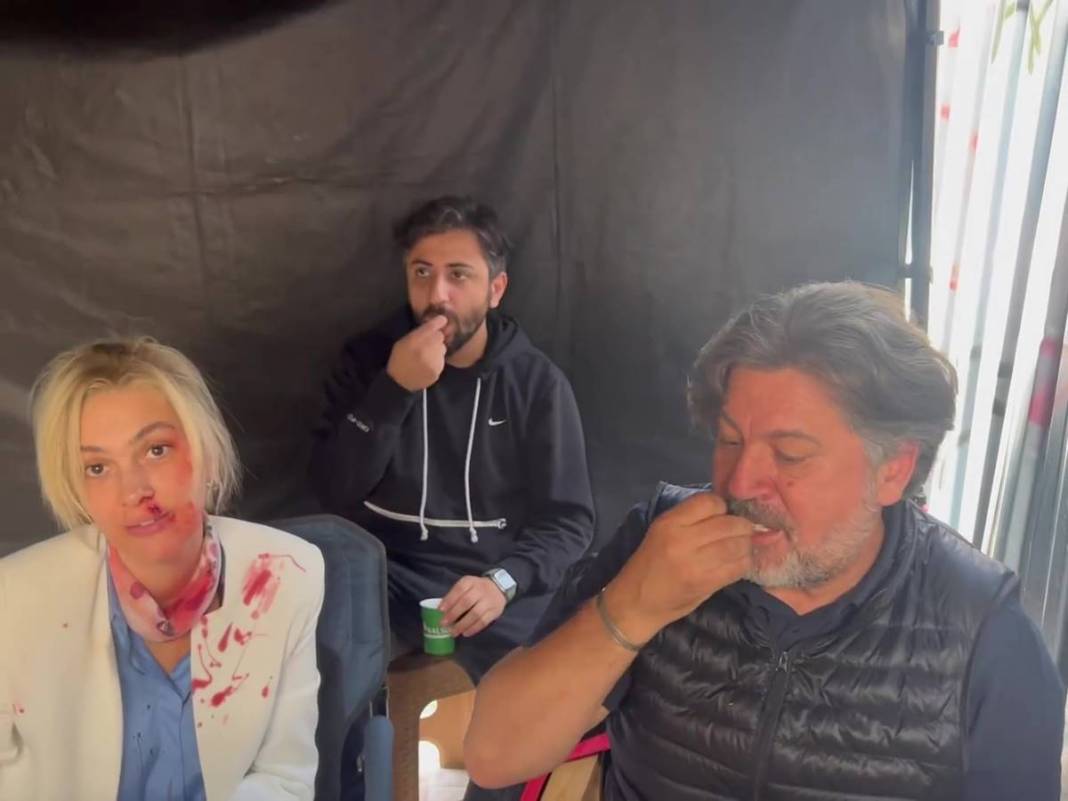 Bergüzar Korel'in kanlı paylaşımı takipçilerini korkuttu! Neden paylaştığı daha sonra ortaya çıktı 5